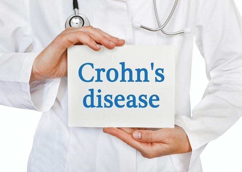 Cannabis and Crohn’s Disease: What You Need to Know